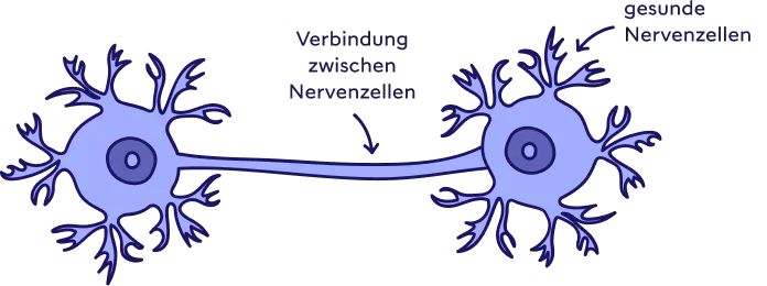 Zwei gesunde Nervenzellen und deren funktionierende Verbindung. 
