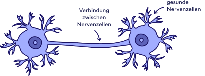 Zwei gesunde Nervenzellen und deren funktionierende Verbindung. 